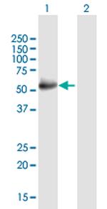 GCK Antibody in Western Blot (WB)