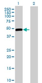 GCK Antibody in Western Blot (WB)