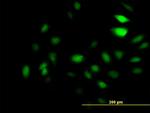 GCN5L2 Antibody in Immunocytochemistry (ICC/IF)