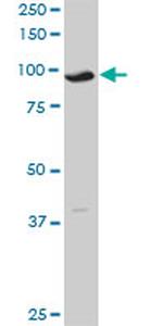 GCN5L2 Antibody in Western Blot (WB)