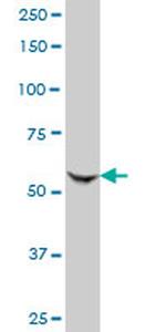 GCN5L2 Antibody in Western Blot (WB)