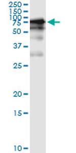 GGT1 Antibody in Immunoprecipitation (IP)