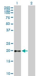 GH1 Antibody in Western Blot (WB)