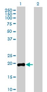 GH1 Antibody in Western Blot (WB)