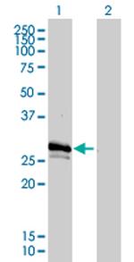 GJB3 Antibody in Western Blot (WB)