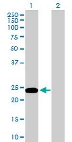 GJB5 Antibody in Western Blot (WB)