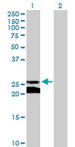 GJB5 Antibody in Western Blot (WB)