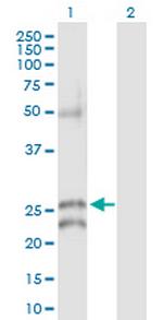 GJB5 Antibody in Western Blot (WB)