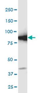 GCLC Antibody in Western Blot (WB)