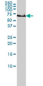 GCLC Antibody in Western Blot (WB)