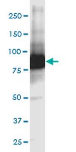 GCLC Antibody in Western Blot (WB)