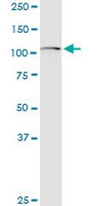 GLI1 Antibody in Western Blot (WB)