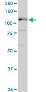 GLI1 Antibody in Western Blot (WB)