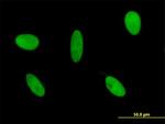 GLI3 Antibody in Immunocytochemistry (ICC/IF)