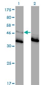 GLRA1 Antibody in Western Blot (WB)