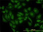 GLS Antibody in Immunocytochemistry (ICC/IF)