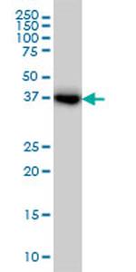 GLUL Antibody in Western Blot (WB)