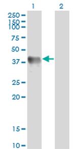 GLUL Antibody in Western Blot (WB)