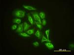 GMFB Antibody in Immunocytochemistry (ICC/IF)