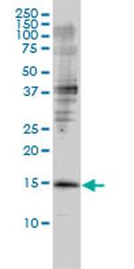 GMFB Antibody in Western Blot (WB)