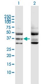 GNA11 Antibody in Western Blot (WB)