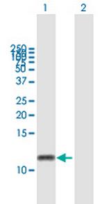 GNGT2 Antibody in Western Blot (WB)