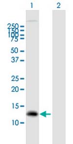 GNRH1 Antibody in Western Blot (WB)