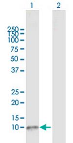 GNRH1 Antibody in Western Blot (WB)