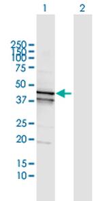 GOT1 Antibody in Western Blot (WB)