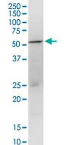 GOT1 Antibody in Western Blot (WB)