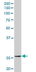 SFN Antibody in Western Blot (WB)