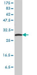 SFN Antibody in Western Blot (WB)