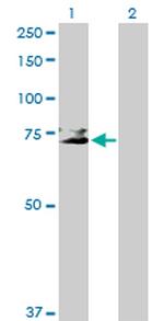 GP1BA Antibody in Western Blot (WB)