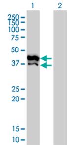 GPD2 Antibody in Western Blot (WB)