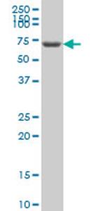 GRK6 Antibody in Western Blot (WB)