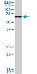 GRK6 Antibody in Western Blot (WB)