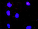 MKNK2 Antibody in Proximity Ligation Assay (PLA) (PLA)