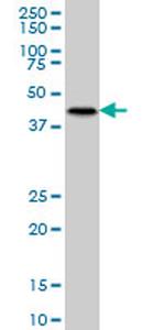 MKNK2 Antibody in Western Blot (WB)