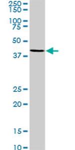 MKNK2 Antibody in Western Blot (WB)