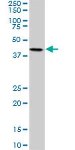 MKNK2 Antibody in Western Blot (WB)