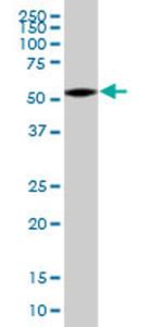 GPS1 Antibody in Western Blot (WB)