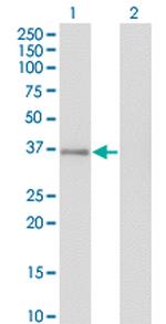 GPS2 Antibody in Western Blot (WB)