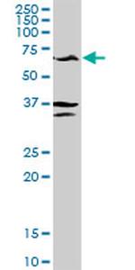 GPT Antibody in Western Blot (WB)