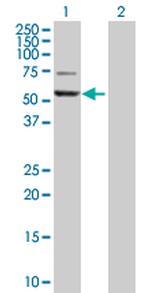 GPT Antibody in Western Blot (WB)