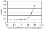 GPT Antibody in ELISA (ELISA)