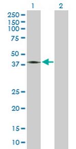 GRIK2 Antibody in Western Blot (WB)