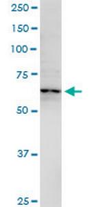 GRIK2 Antibody in Western Blot (WB)