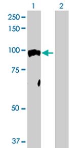 NR3C1 Antibody in Western Blot (WB)