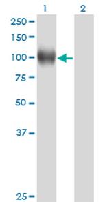 NR3C1 Antibody in Western Blot (WB)