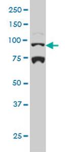 NR3C1 Antibody in Western Blot (WB)